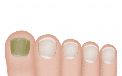 Understanding “Green” Nail Stains