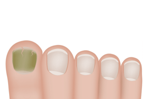Understanding “Green” Nail Stains