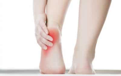 The Scoop on Corns and Calluses